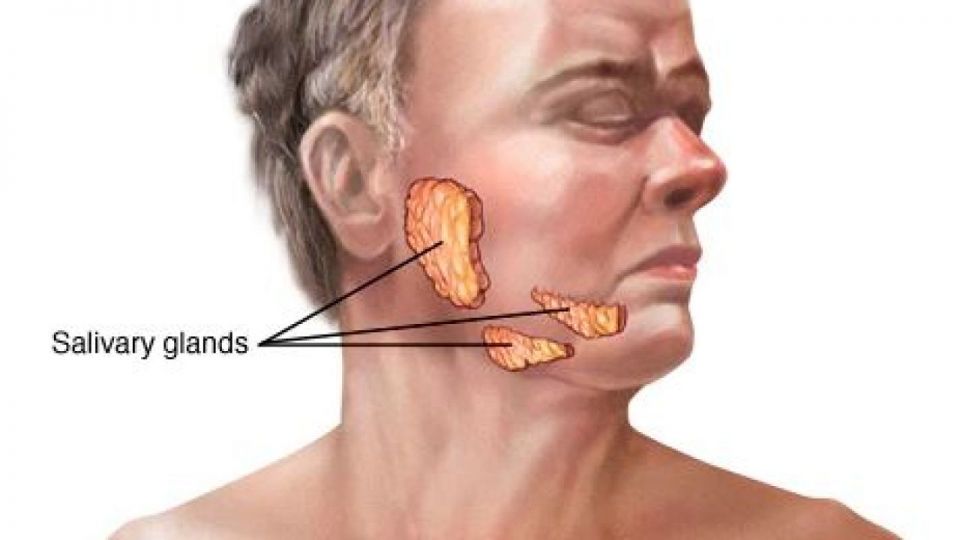 Mumps Virus, Testicles ,  saliva-producing glands,  salivary, epidemic parotitis